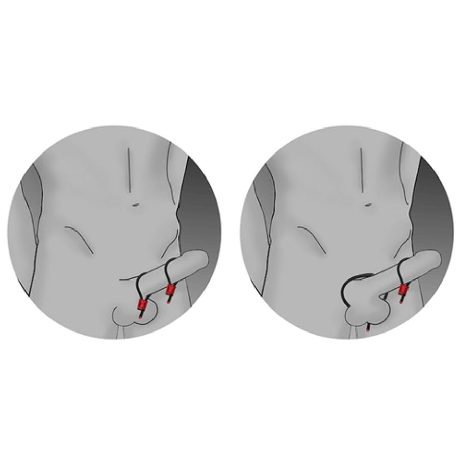 ELECTRASTIM Prestige Electra Loops Anneaux Péniens Réglables Rouges — vue alternative